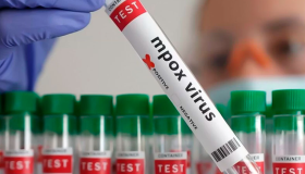 Francia detecta virus de mpox 