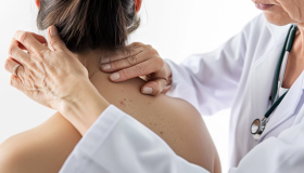 La vitamina B3: un aliado contra el cáncer de piel 