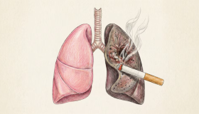 ¿Por qué aparece el cáncer de pulmón en personas que nunca han fumado? 