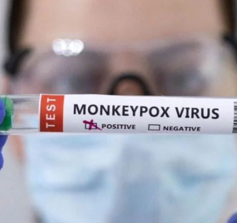 Pakistán registró su primer caso de viruela del mono y dos sospechosos