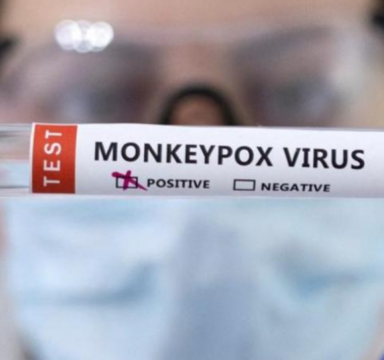 Honduras instala salas de vigilancia epidemiológica para detectar posibles casos de mpox