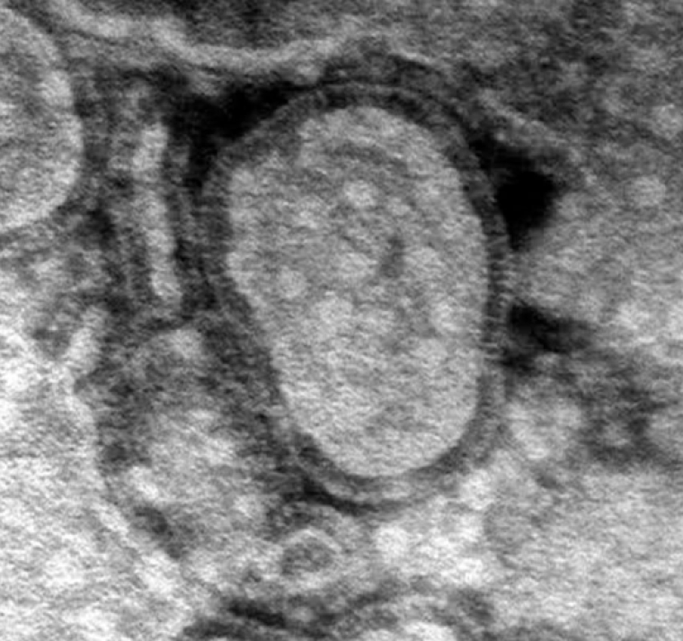 China enfrenta nuevos problemas con una enfermedad respiratoria similar al Covid-19 