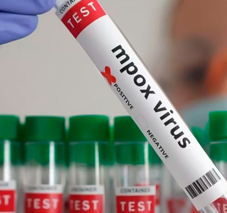 Francia detecta virus de mpox 