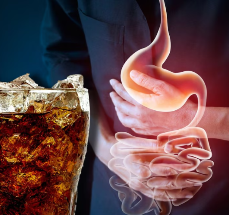 Así impacta el consumo diario de gaseosas en la salud 