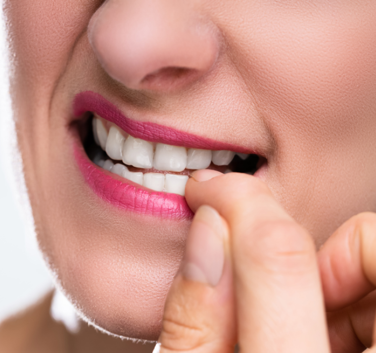 Onicofagia: cuando morderse las uñas se convierte en un riesgo para la salud 
